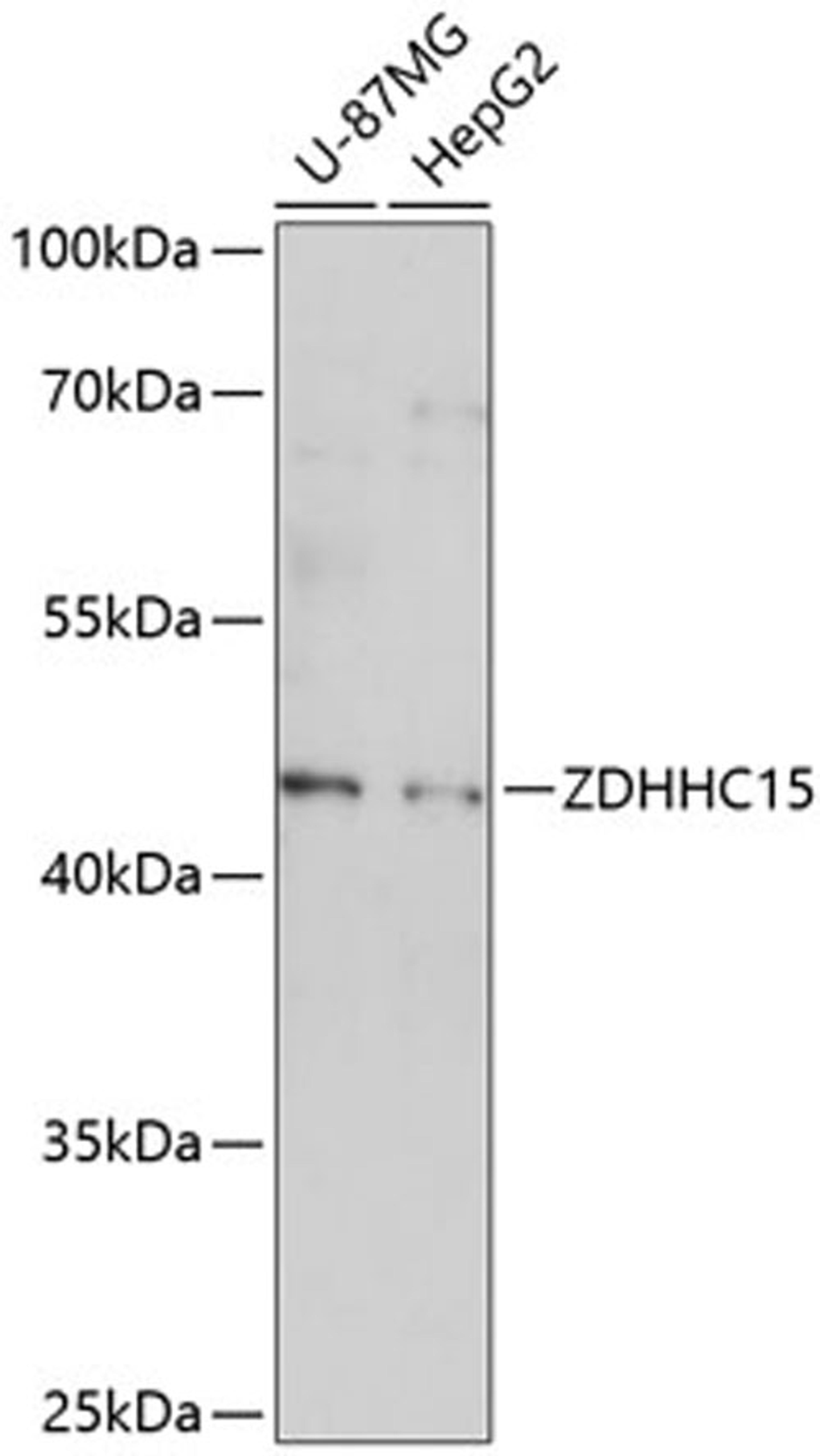 Western blot - ZDHHC15 antibody (A14454)