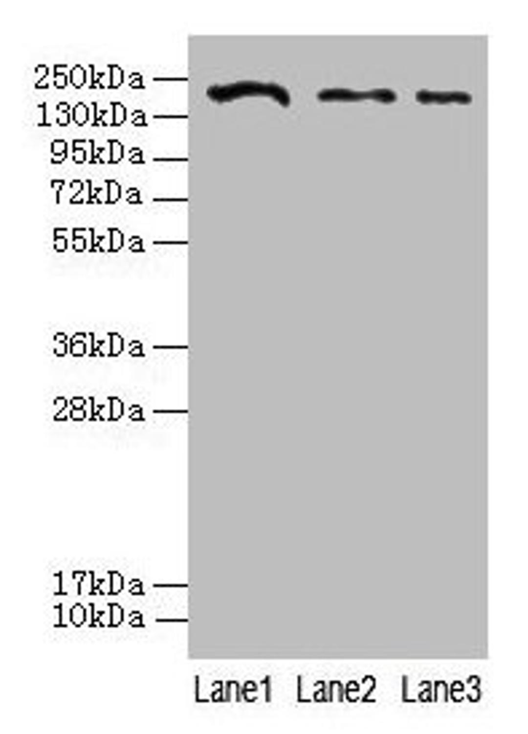 Western blot. All lanes: CLTCL1 antibody at 2µg/ml. Lane 1: Jurkat whole cell lysate. Lane 2: NIH/3T3 whole cell lysate. Lane 3: A431 whole cell lysate. Secondary. Goat polyclonal to rabbit IgG at 1/10000 dilution. Predicted band size: 188, 181 kDa. Observed band size: 188 kDa