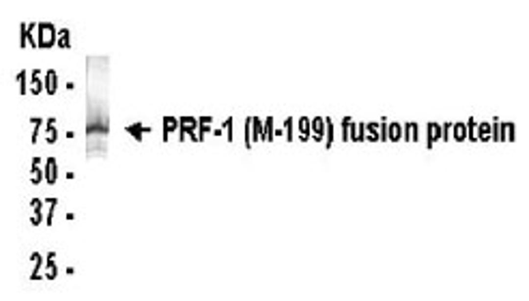 Western blot detection of PRF-1 (M-199) antibody.