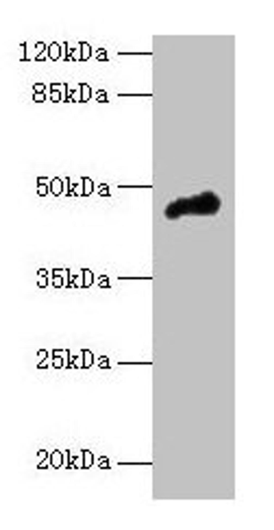 Western blot. All lanes: CASQ1 antibody at 5µg/ml + Mouse brain tissue. Secondary. Goat polyclonal to rabbit IgG at 1/10000 dilution. Predicted band size: 46 kDa. Observed band size: 46 kDa