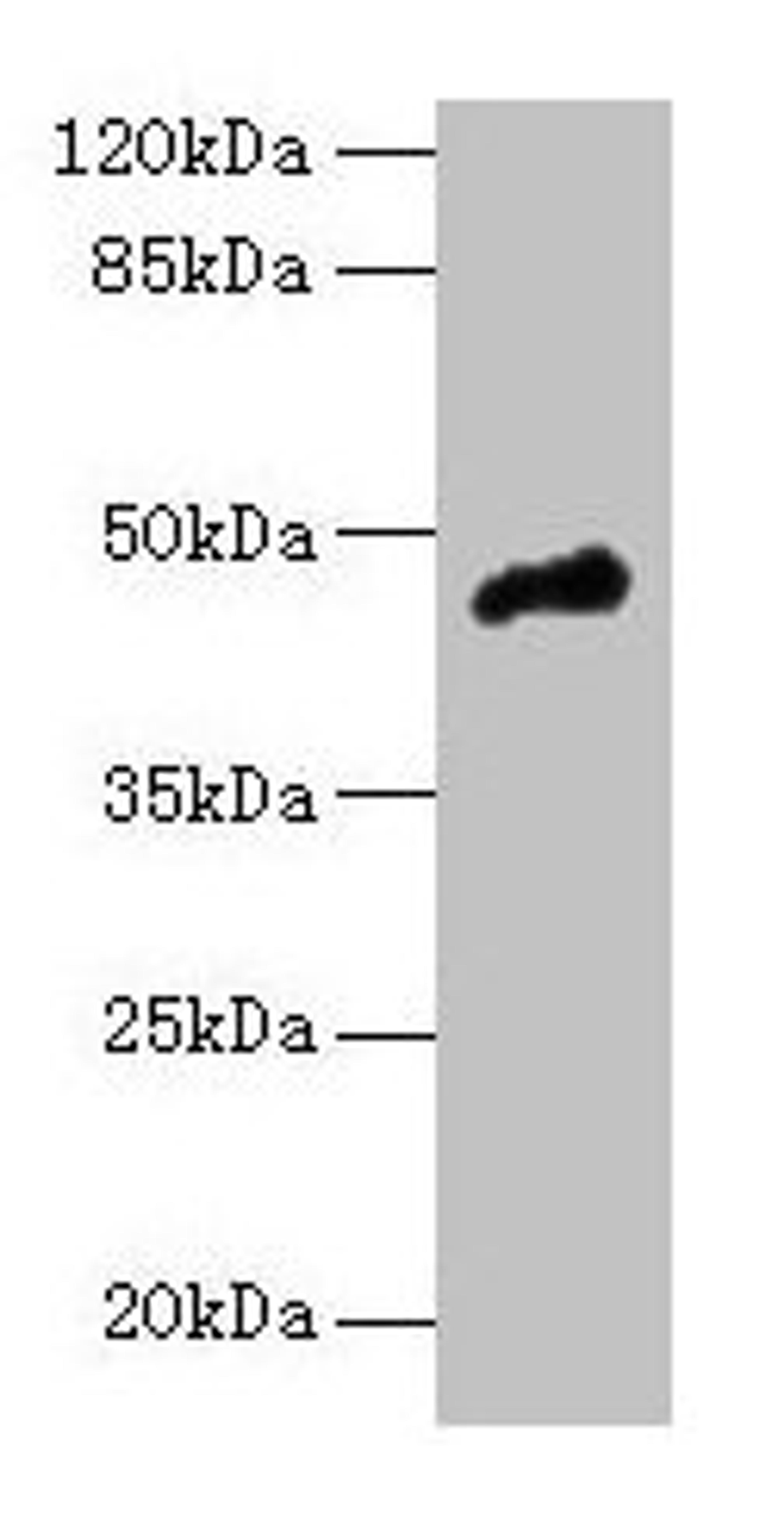 Western blot. All lanes: CASQ1 antibody at 5µg/ml + Mouse brain tissue. Secondary. Goat polyclonal to rabbit IgG at 1/10000 dilution. Predicted band size: 46 kDa. Observed band size: 46 kDa