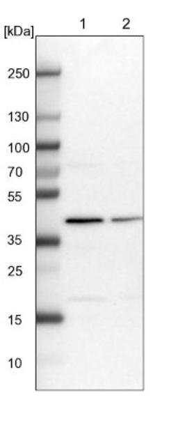 Western Blot: PSMD13 Antibody [NBP1-80961] - Lane 1: NIH-3T3 cell lysate (Mouse embryonic fibroblast cells)<br/>Lane 2: NBT-II cell lysate (Rat Wistar bladder tumour cells)