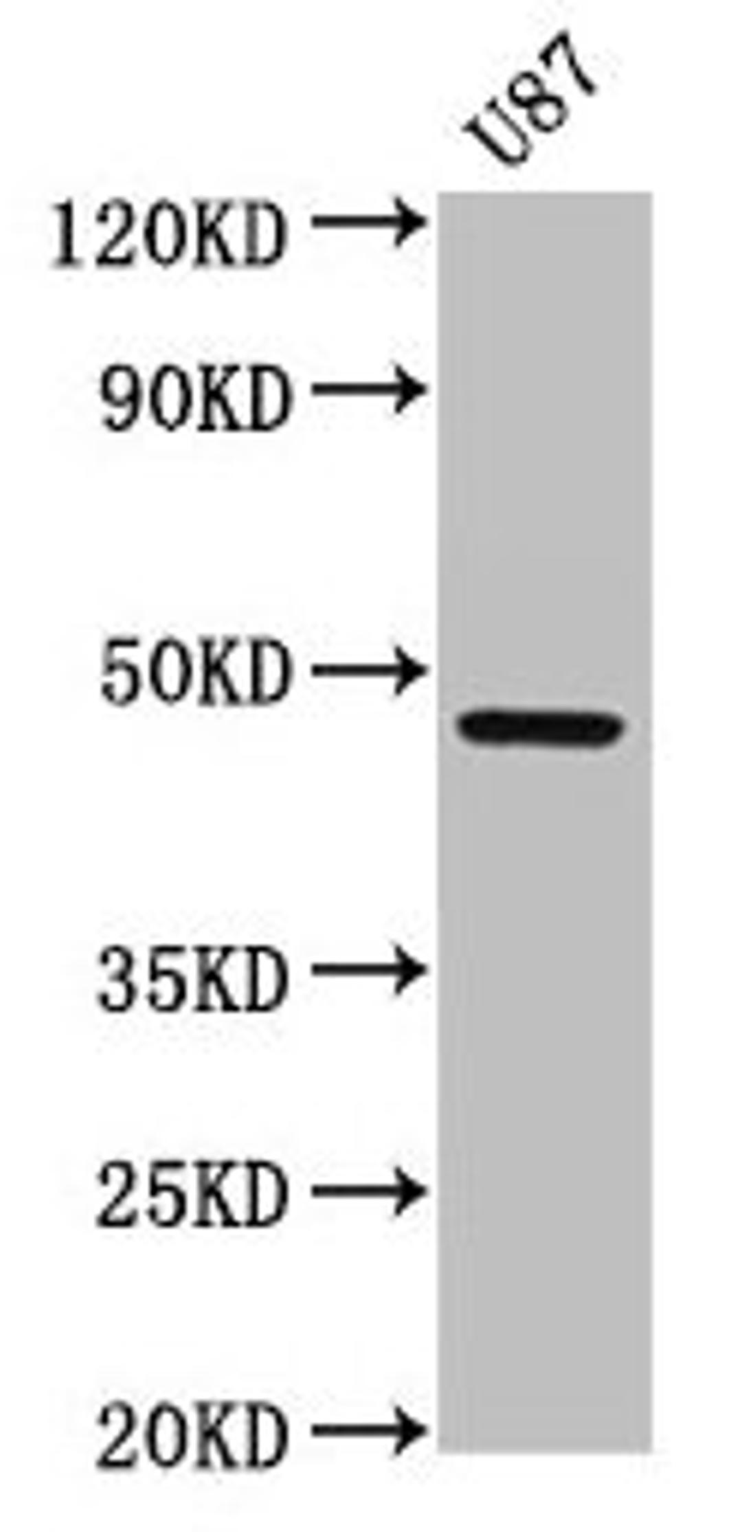 Western Blot. Positive WB detected in: U87 whole cell lysate. All lanes: SERPINA6 antibody at 2.7µg/ml. Secondary. Goat polyclonal to rabbit IgG at 1/50000 dilution. Predicted band size: 46 kDa. Observed band size: 46 kDa