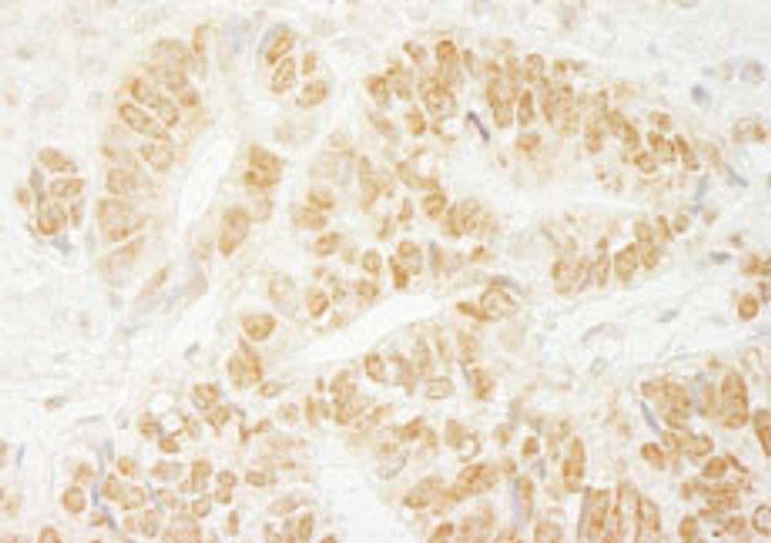 Detection of human PA1 by immunohistochemistry.