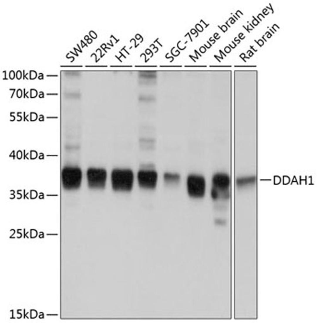 Western blot - DDAH1 antibody (A10295)