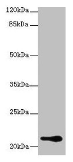 Western blot. All lanes: RBBP9 antibody at 1µg/ml + A375 whole cell lysate. Secondary. Goat polyclonal to rabbit IgG at 1/10000 dilution. Predicted band size: 21, 20 kDa. Observed band size: 21 kDa