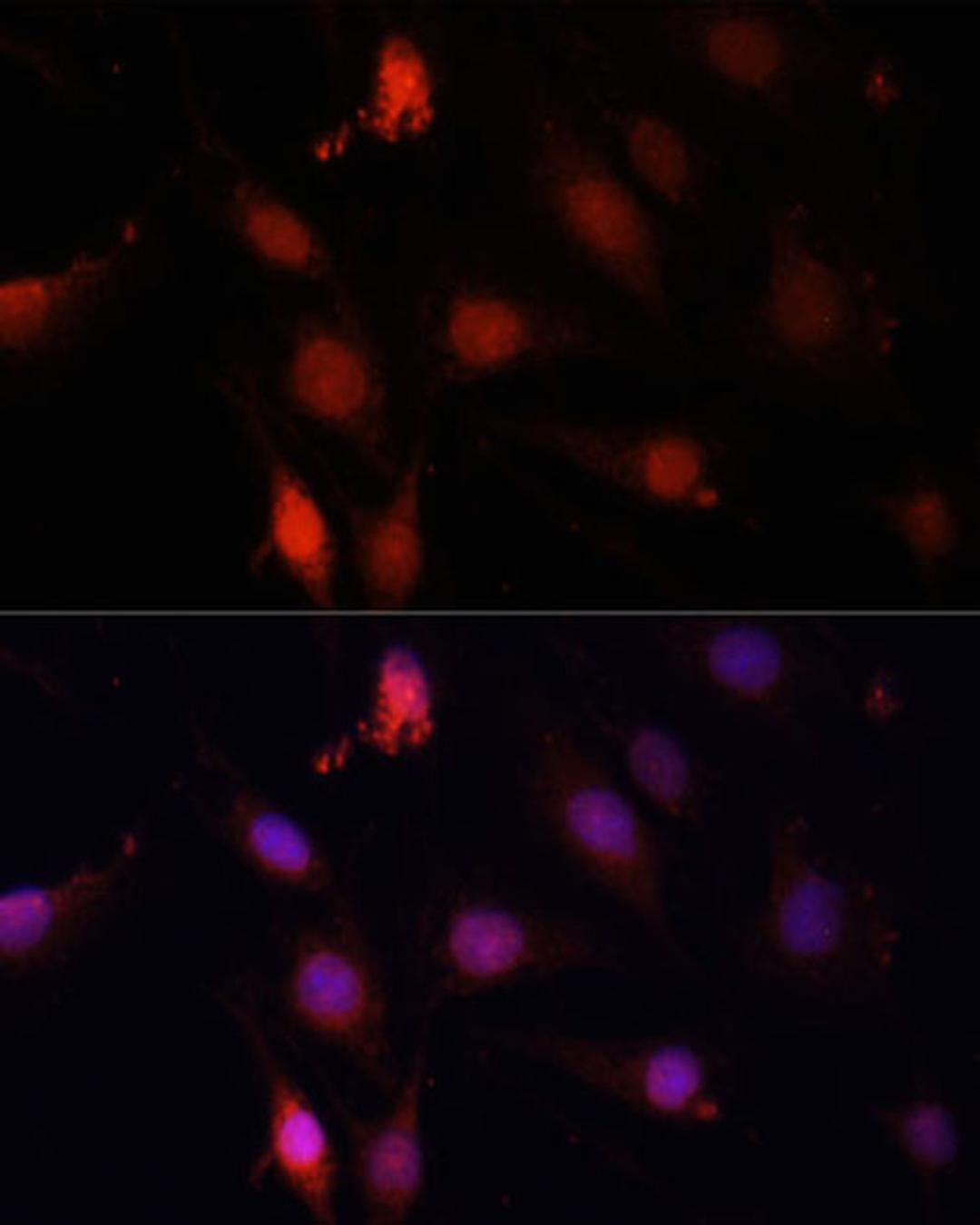 Immunofluorescence - GBX2 antibody (A14733)