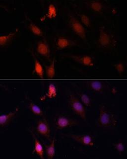 Immunofluorescence - GBX2 antibody (A14733)