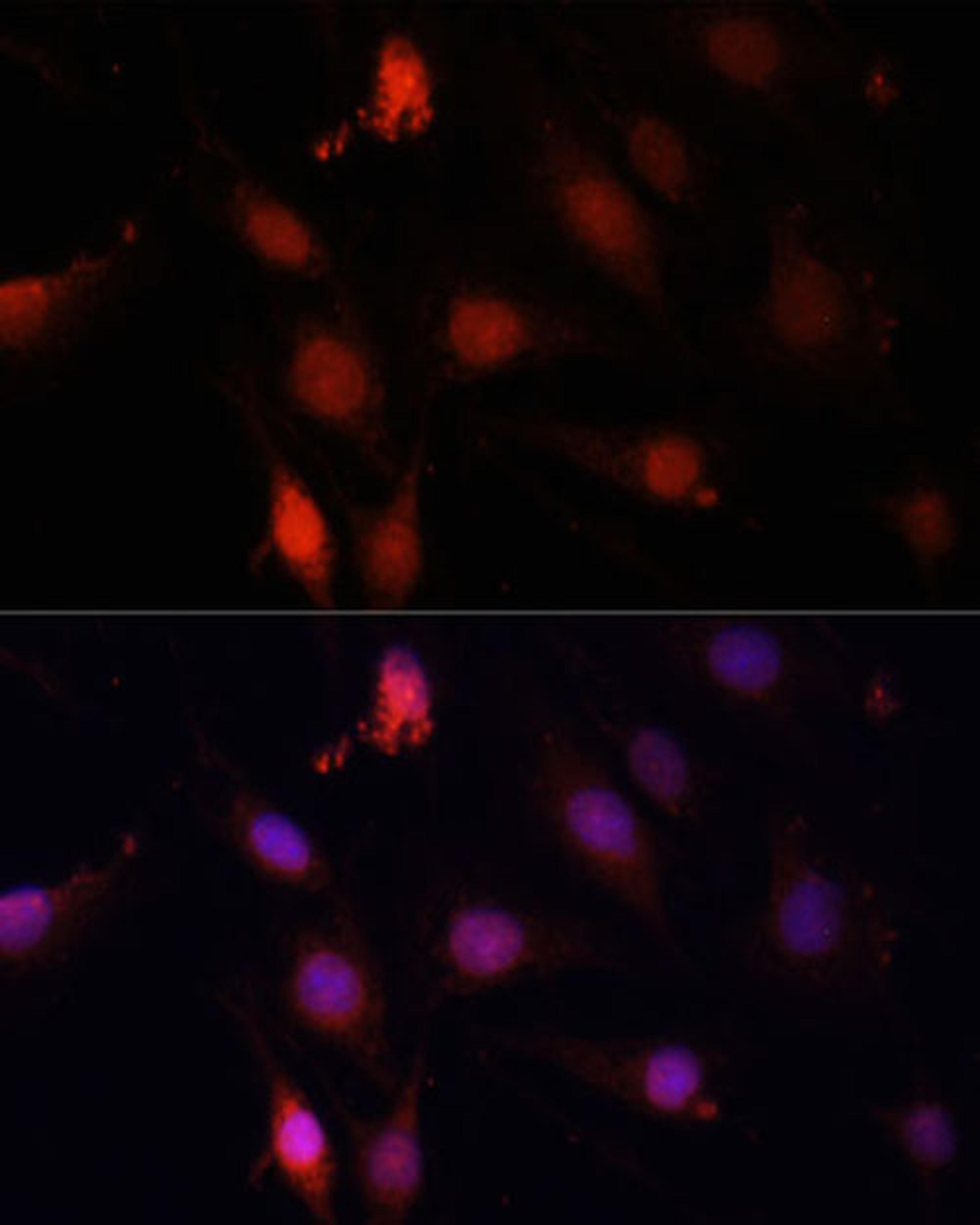 Immunofluorescence - GBX2 antibody (A14733)