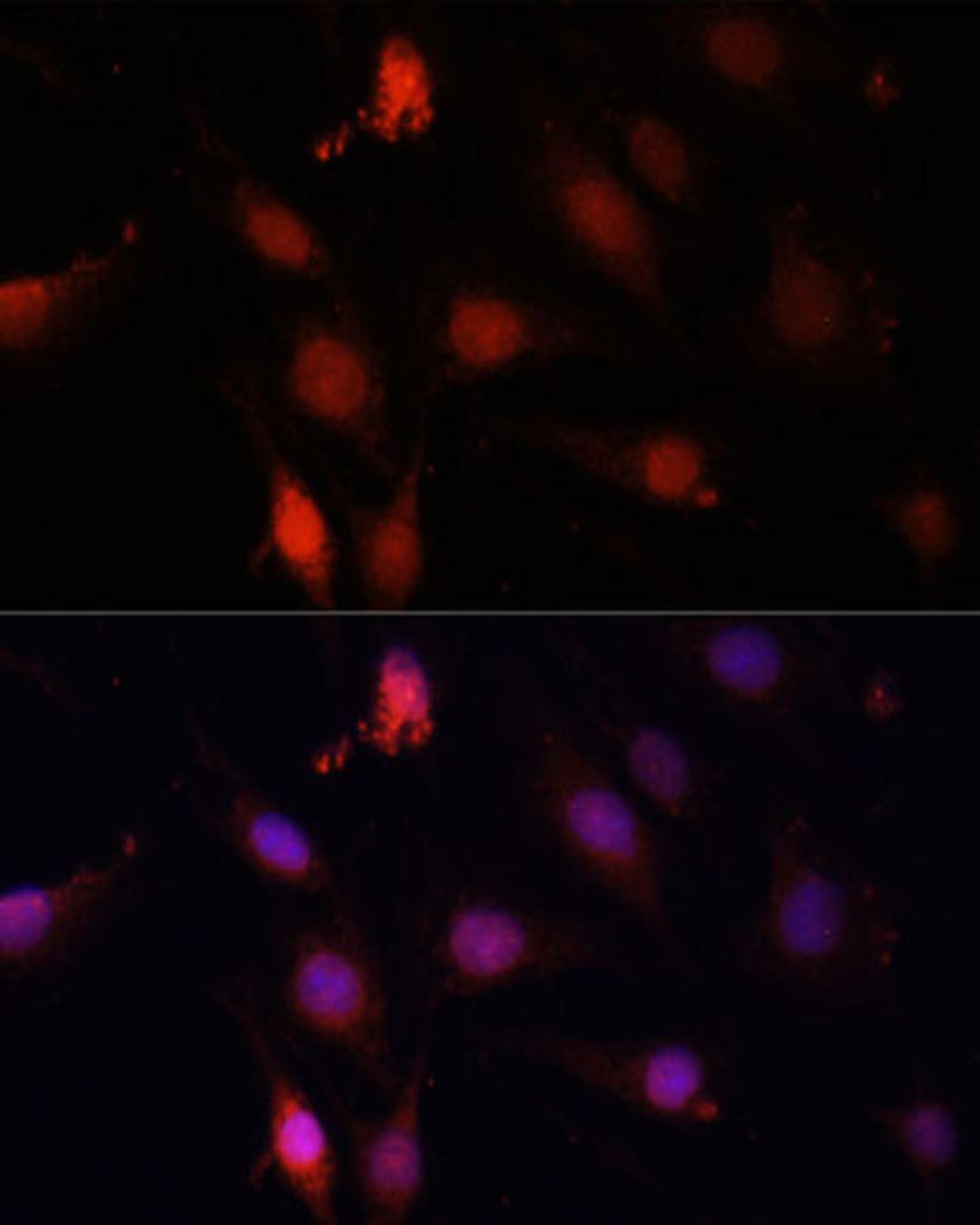 Immunofluorescence - GBX2 antibody (A14733)