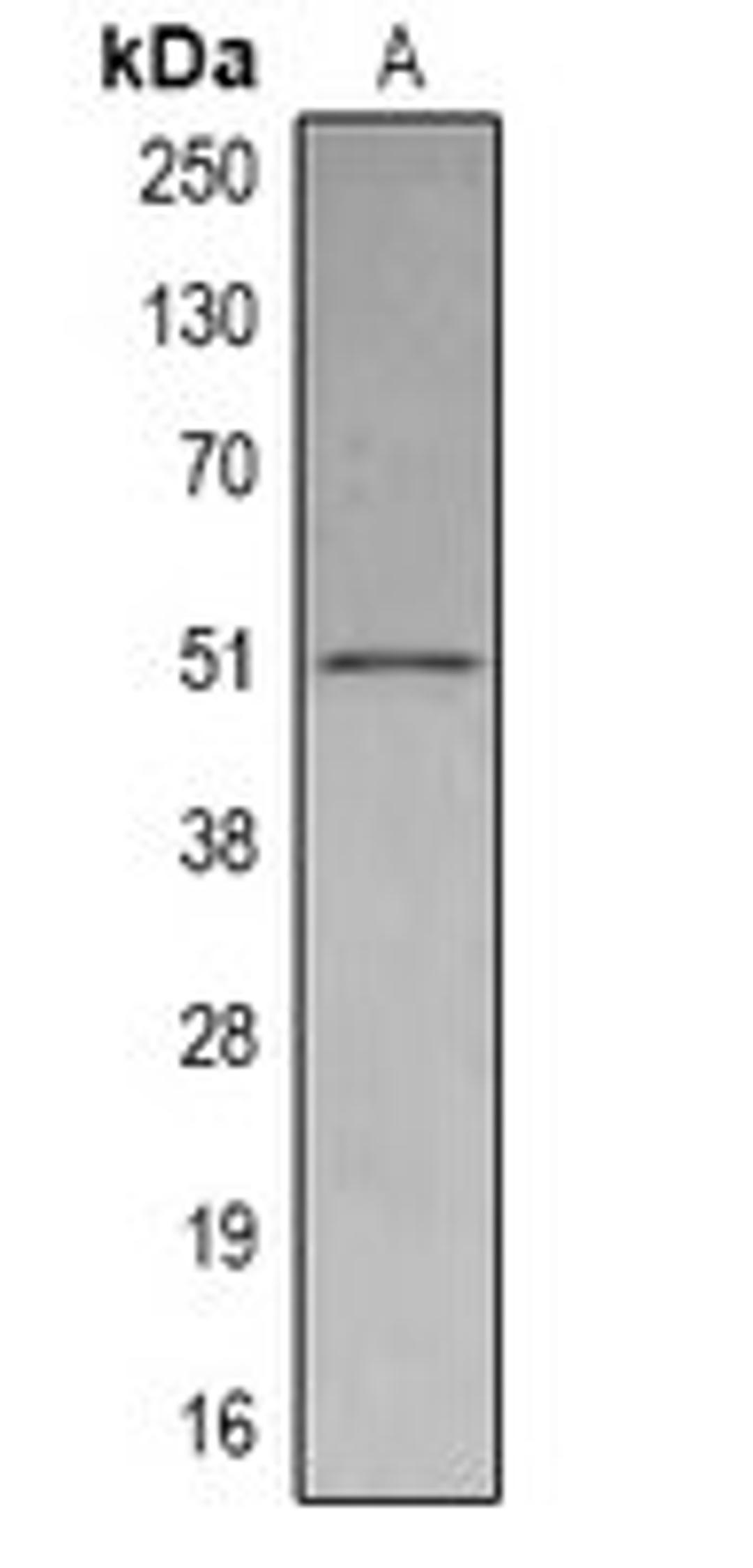 Western blot analysis of THP1 (Lane1) whole cell lysates using SETD6 antibody