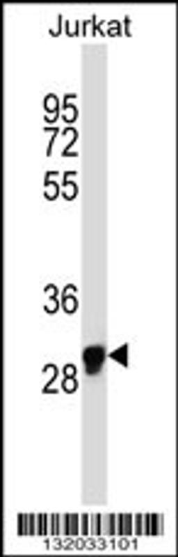 Western blot analysis in Jurkat cell line lysates (35ug/lane).