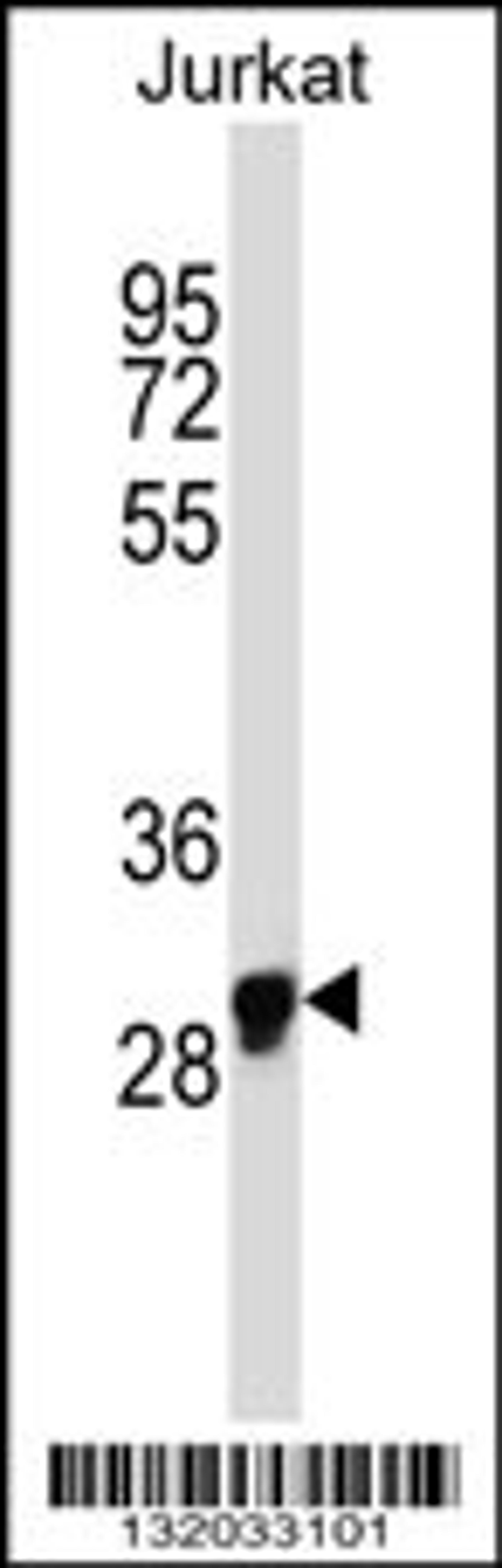 Western blot analysis in Jurkat cell line lysates (35ug/lane).