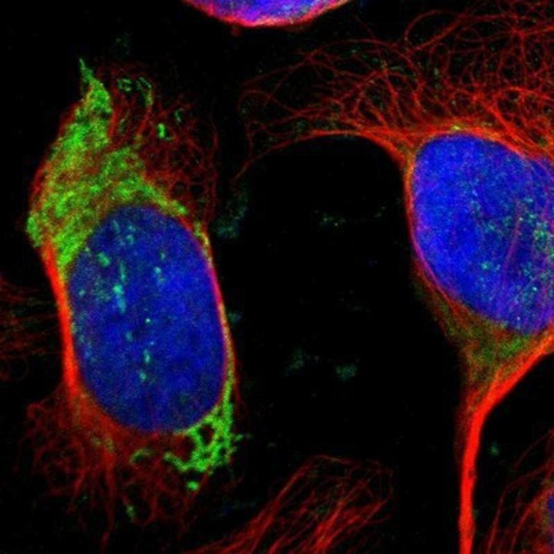 Immunocytochemistry/Immunofluorescence: Ornithine Carbamoyltransferase Antibody [NBP1-87408] - Staining of human cell line U-2 OS shows positivity in mitochondria.