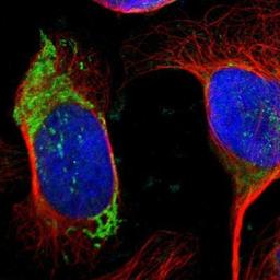 Immunocytochemistry/Immunofluorescence: Ornithine Carbamoyltransferase Antibody [NBP1-87408] - Staining of human cell line U-2 OS shows positivity in mitochondria.