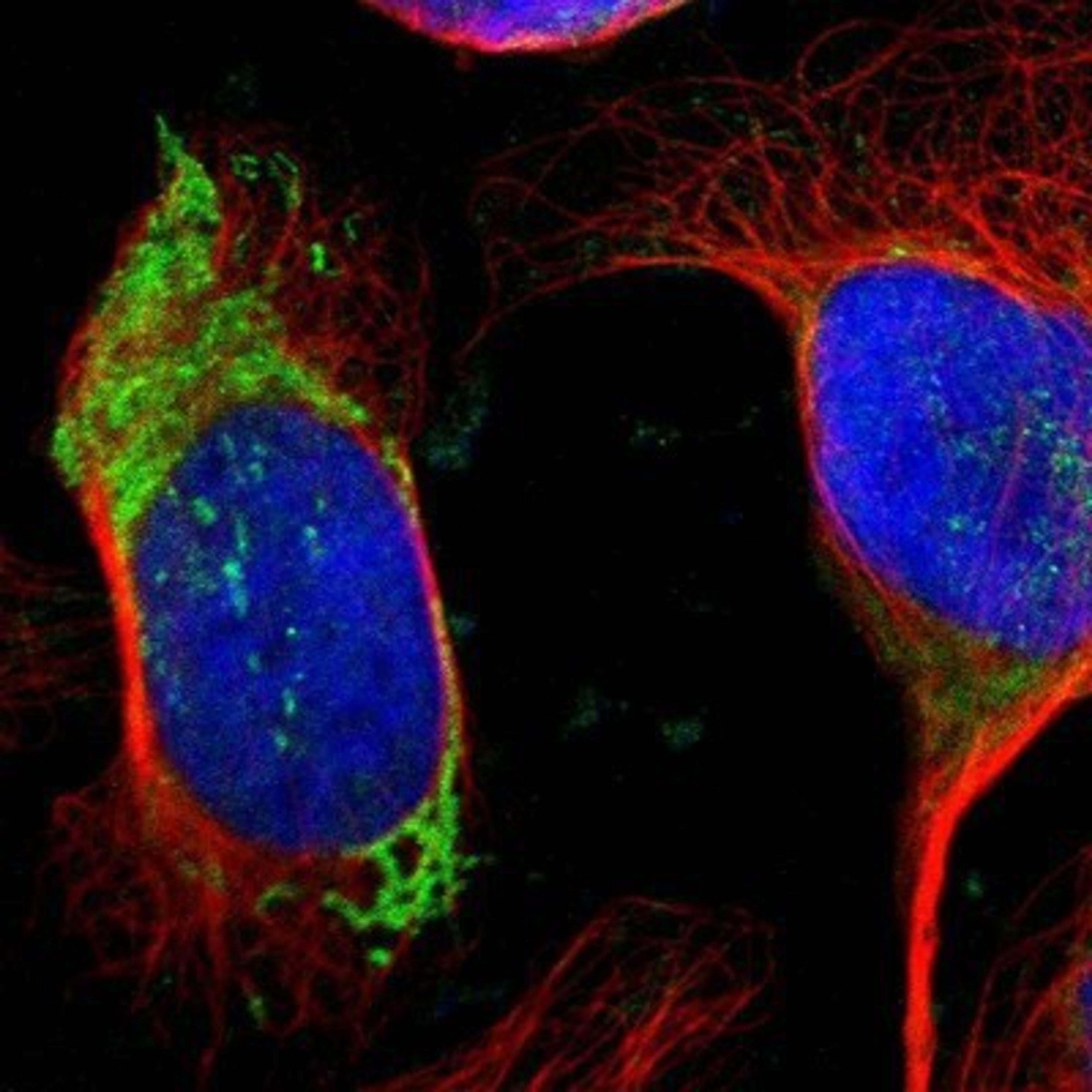 Immunocytochemistry/Immunofluorescence: Ornithine Carbamoyltransferase Antibody [NBP1-87408] - Staining of human cell line U-2 OS shows positivity in mitochondria.