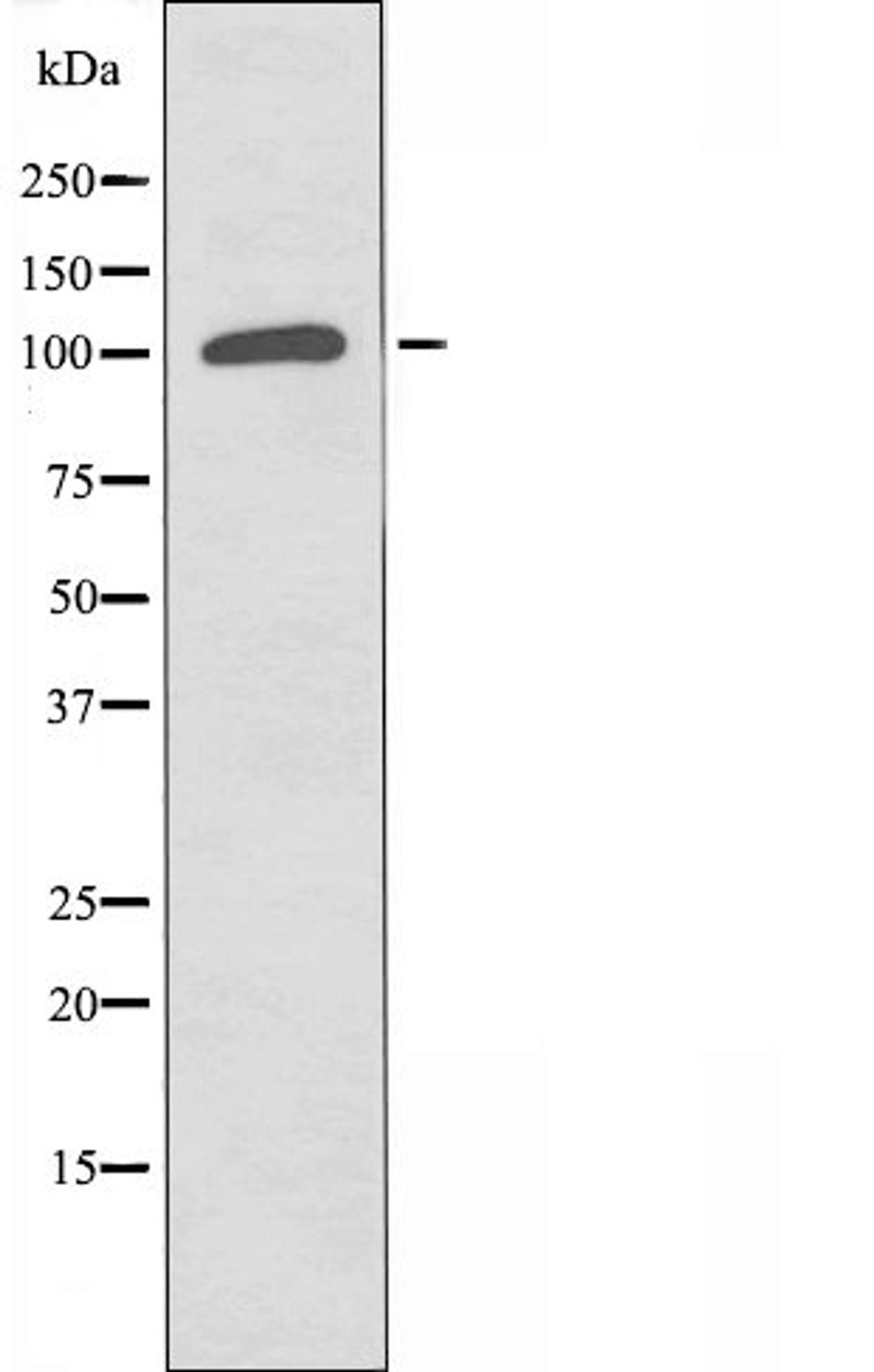 Western blot analysis of Jurkat cells using RANBP17 antibody