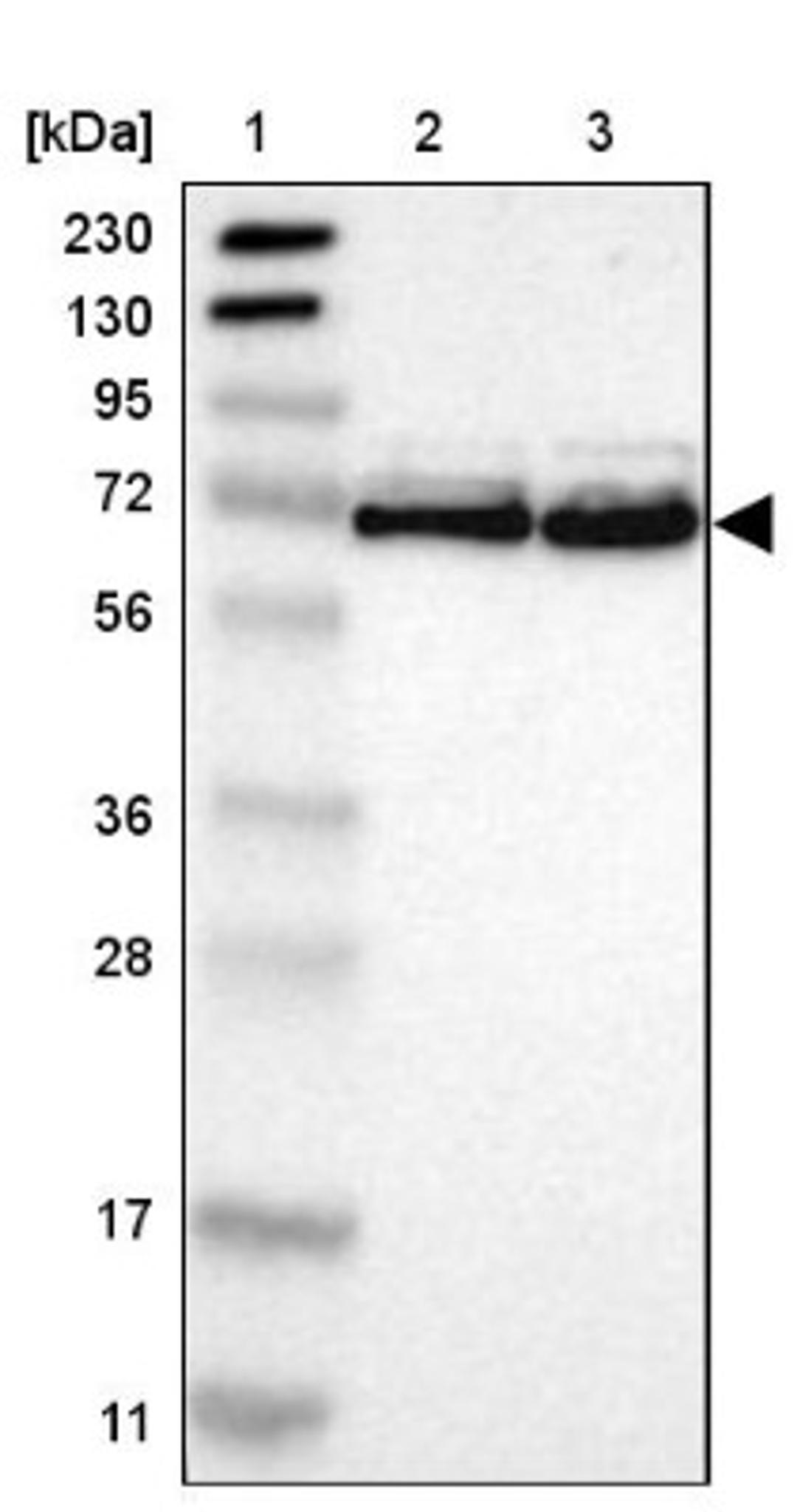 Western Blot: FUS Antibody [NBP1-89113] - Lane 1: Marker [kDa] 230, 130, 95, 72, 56, 36, 28, 17, 11<br/>Lane 2: Human cell line RT-4<br/>Lane 3: Human cell line U-251MG sp