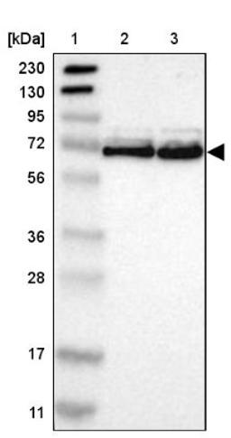 Western Blot: FUS Antibody [NBP1-89113] - Lane 1: Marker [kDa] 230, 130, 95, 72, 56, 36, 28, 17, 11<br/>Lane 2: Human cell line RT-4<br/>Lane 3: Human cell line U-251MG sp