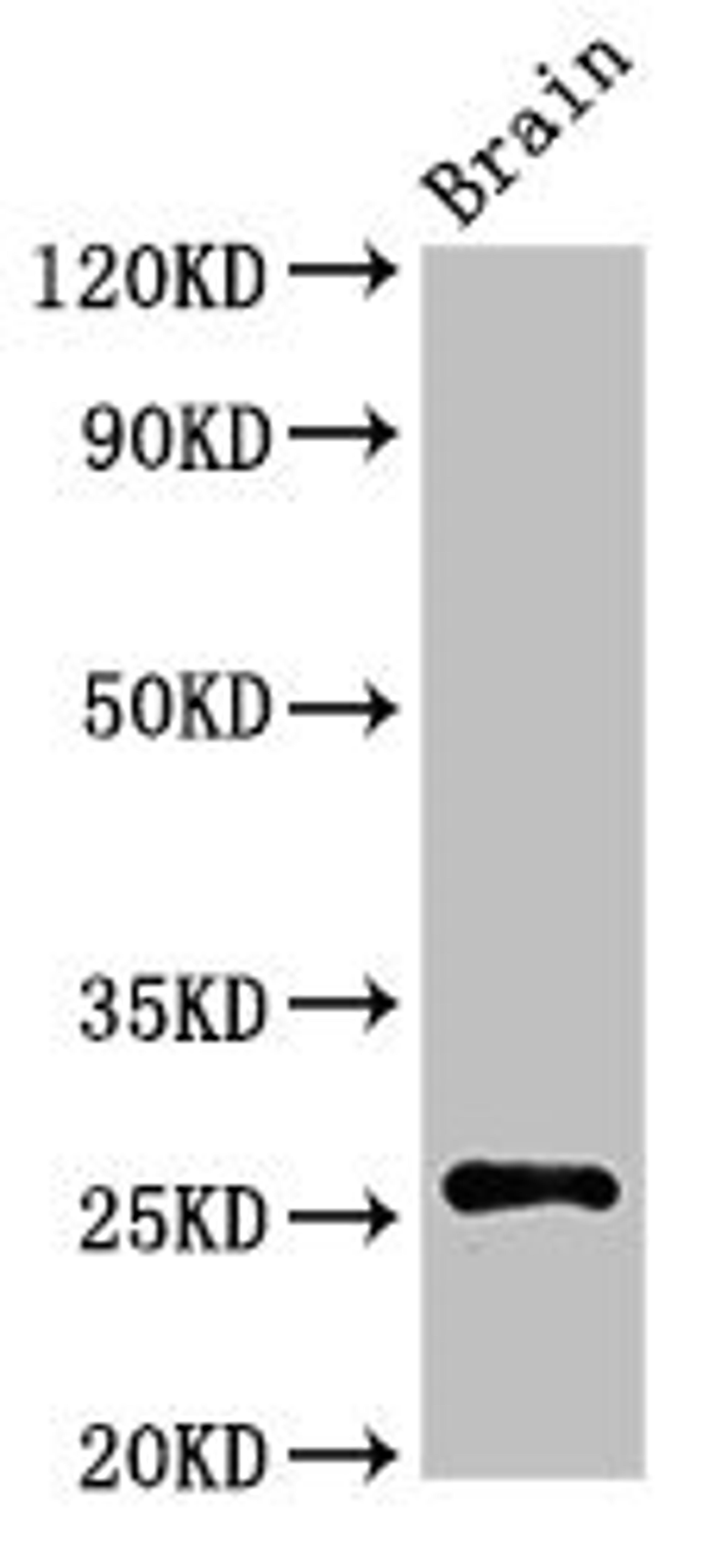Western Blot. Positive WB detected in: Rat brain tissue. All lanes: ASCL1 antibody at 3ug/ml. Secondary. Goat polyclonal to rabbit IgG at 1/50000 dilution. Predicted band size: 26 kDa. Observed band size: 26 kDa.
