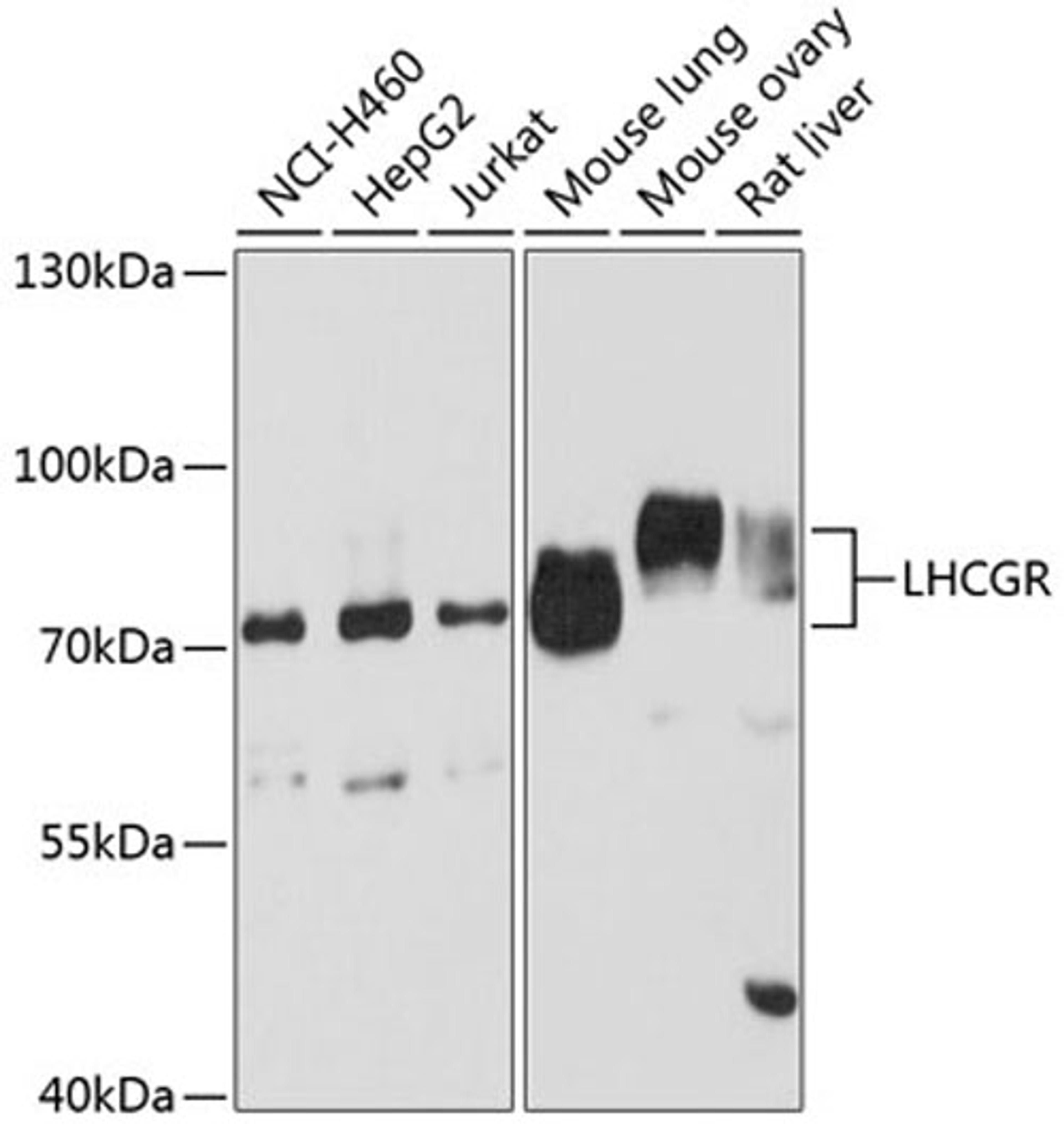 Western blot - LHCGR antibody (A6266)