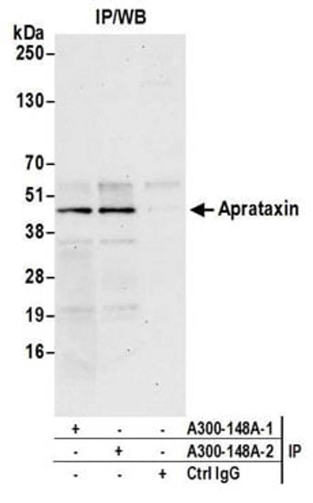 Detection of human Aprataxin by western blot of immunoprecipitates.