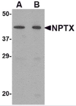 Western blot analysis of NPTX2 in mouse brain tissue lysate with NPTX2 antibody at (A) 0.5 and (B) 1 &#956;g/mL.