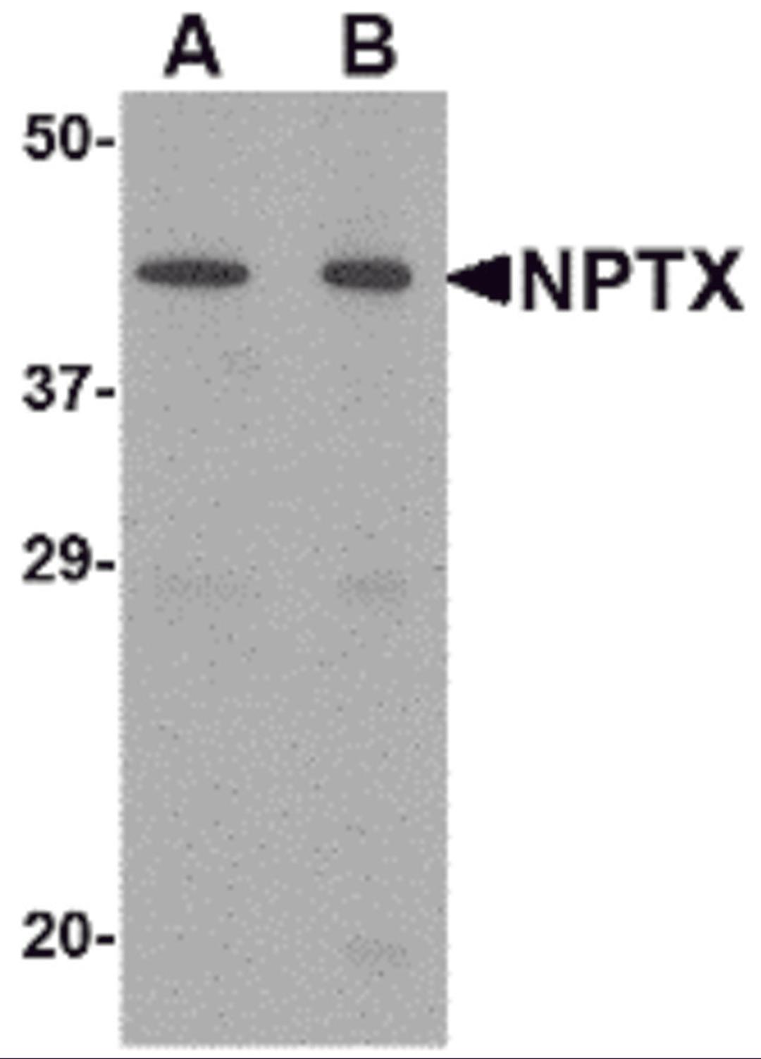 Western blot analysis of NPTX2 in mouse brain tissue lysate with NPTX2 antibody at (A) 0.5 and (B) 1 μg/mL.