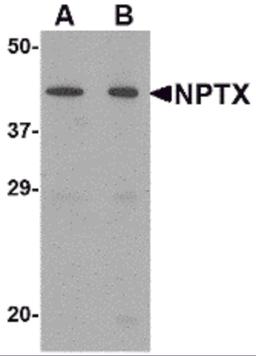 Western blot analysis of NPTX2 in mouse brain tissue lysate with NPTX2 antibody at (A) 0.5 and (B) 1 μg/mL.