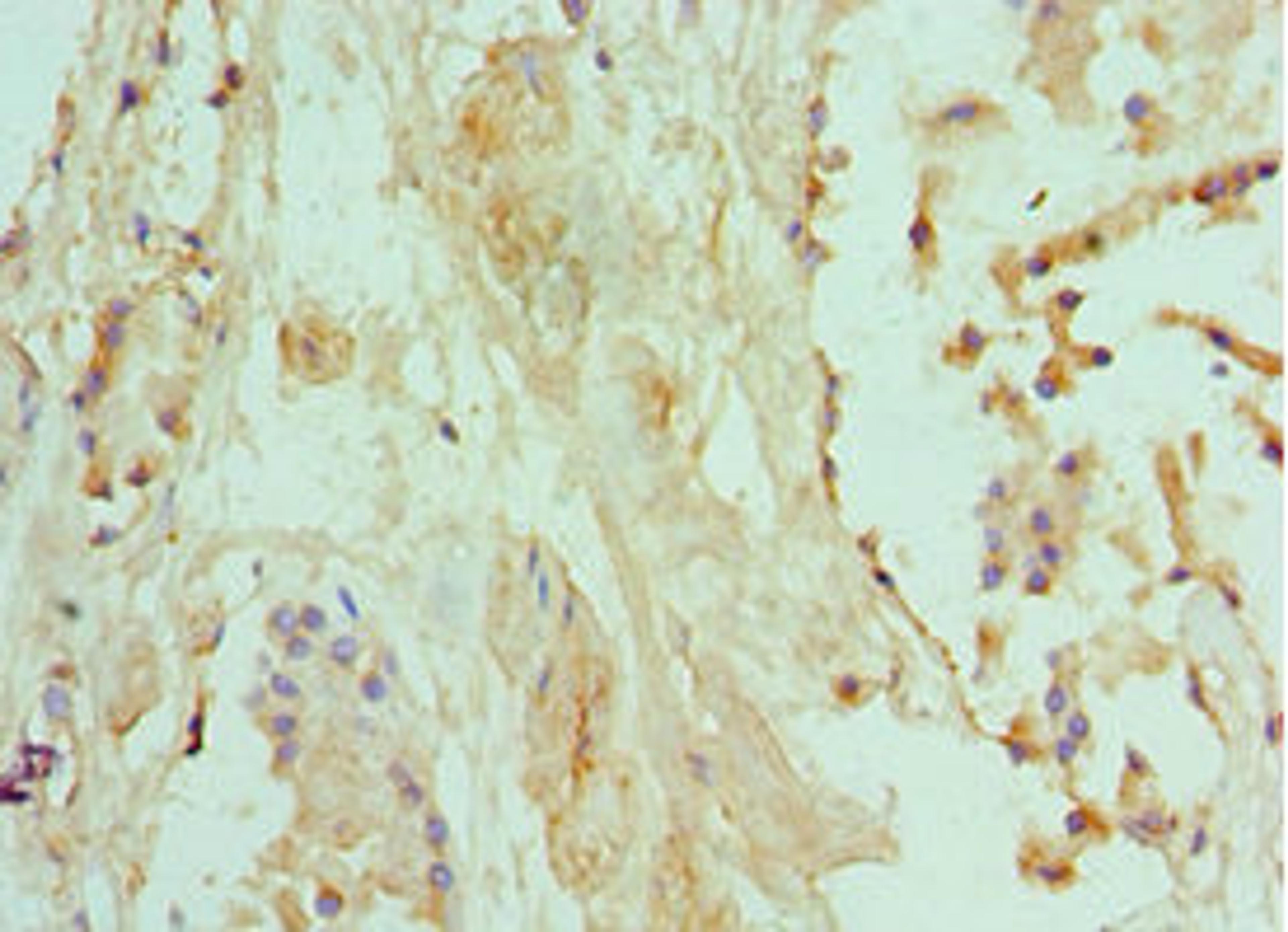 Immunohistochemistry of paraffin-embedded human prostate tissue using CSB-PA618642ESR1HU at dilution of 1:100