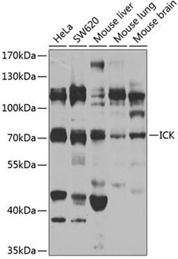 Western blot - ICK antibody (A7783)