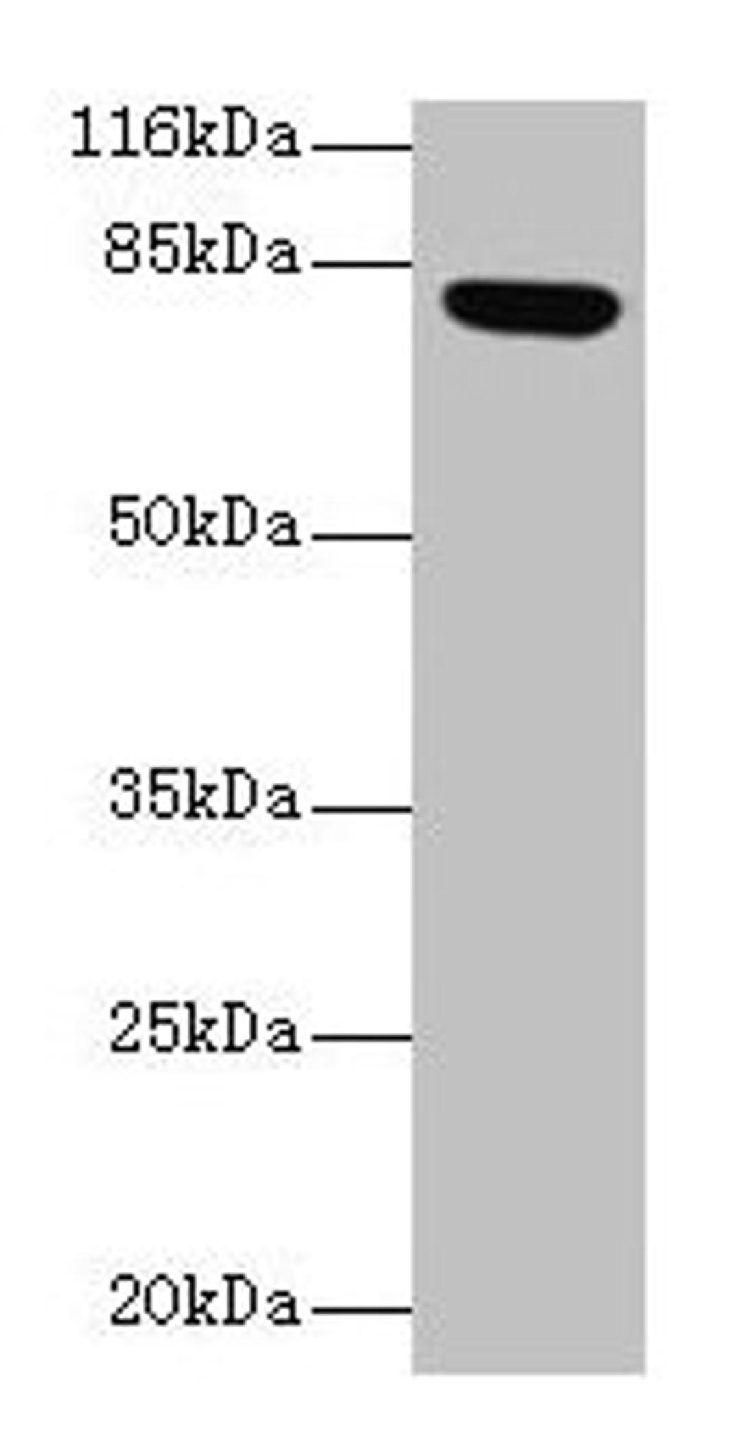 Western blot. All lanes: Lhcgr antibody at 2µg/ml + Rat gonadal tissue. Secondary. Goat polyclonal to rabbit IgG at 1/10000 dilution. Predicted band size: 79, 35, 38, 73, 28, 33, 21, 72, 31, 34, 41 kDa. Observed band size: 79 kDa