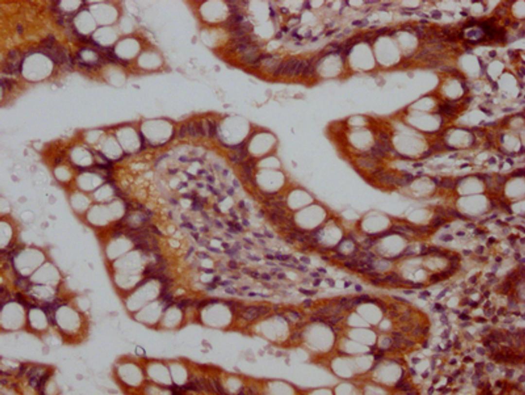 IHC image of CSB-RA581950A0HU diluted at 1:100 and staining in paraffin-embedded human small intestine tissue performed on a Leica BondTM system. After dewaxing and hydration, antigen retrieval was mediated by high pressure in a citrate buffer (pH 6.0). Section was blocked with 10% normal goat serum 30min at RT. Then primary antibody (1% BSA) was incubated at 4℃ overnight. The primary is detected by a Goat anti-rabbit IgG polymer labeled by HRP and visualized using 0.05% DAB.