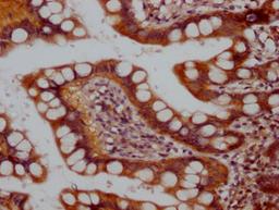 IHC image of CSB-RA581950A0HU diluted at 1:100 and staining in paraffin-embedded human small intestine tissue performed on a Leica BondTM system. After dewaxing and hydration, antigen retrieval was mediated by high pressure in a citrate buffer (pH 6.0). Section was blocked with 10% normal goat serum 30min at RT. Then primary antibody (1% BSA) was incubated at 4℃ overnight. The primary is detected by a Goat anti-rabbit IgG polymer labeled by HRP and visualized using 0.05% DAB.