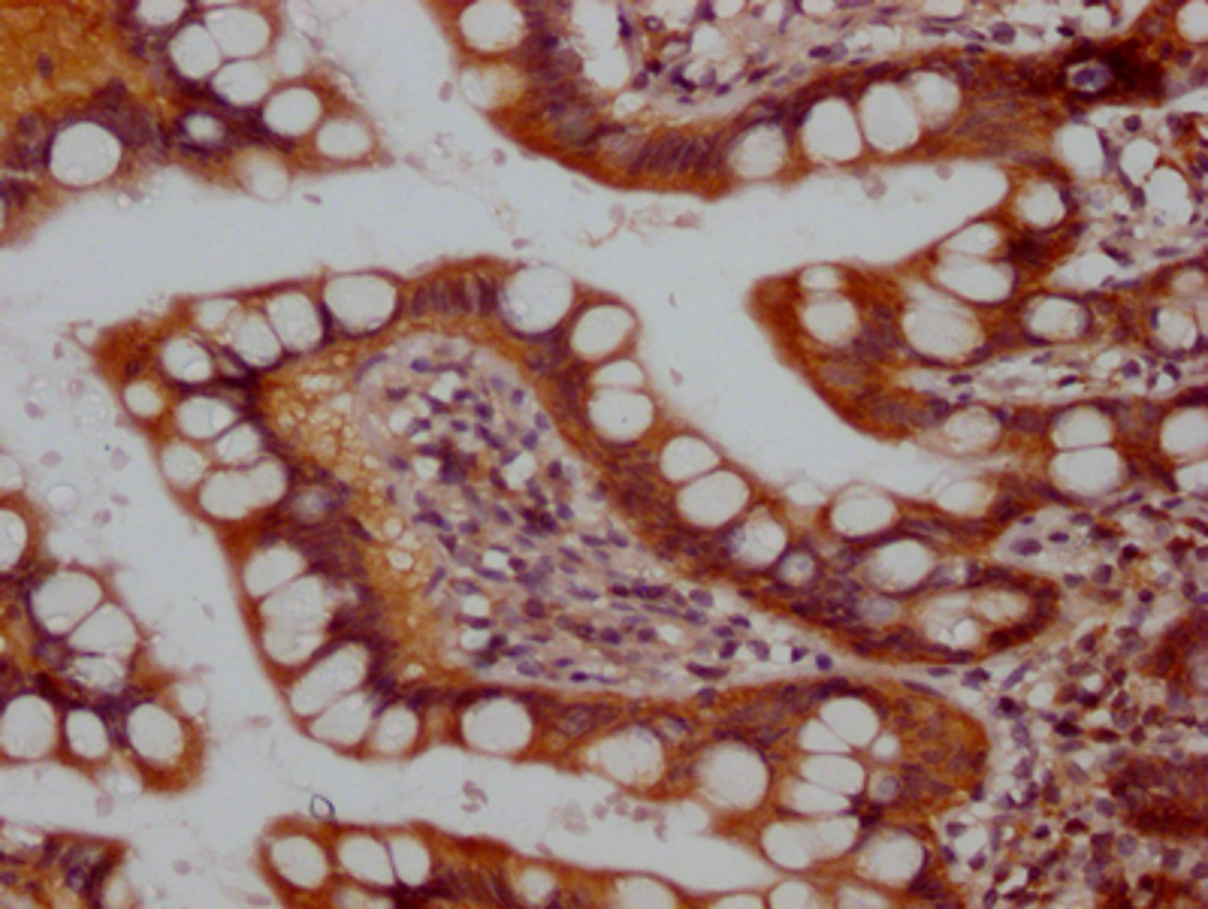 IHC image of CSB-RA581950A0HU diluted at 1:100 and staining in paraffin-embedded human small intestine tissue performed on a Leica BondTM system. After dewaxing and hydration, antigen retrieval was mediated by high pressure in a citrate buffer (pH 6.0). Section was blocked with 10% normal goat serum 30min at RT. Then primary antibody (1% BSA) was incubated at 4℃ overnight. The primary is detected by a Goat anti-rabbit IgG polymer labeled by HRP and visualized using 0.05% DAB.