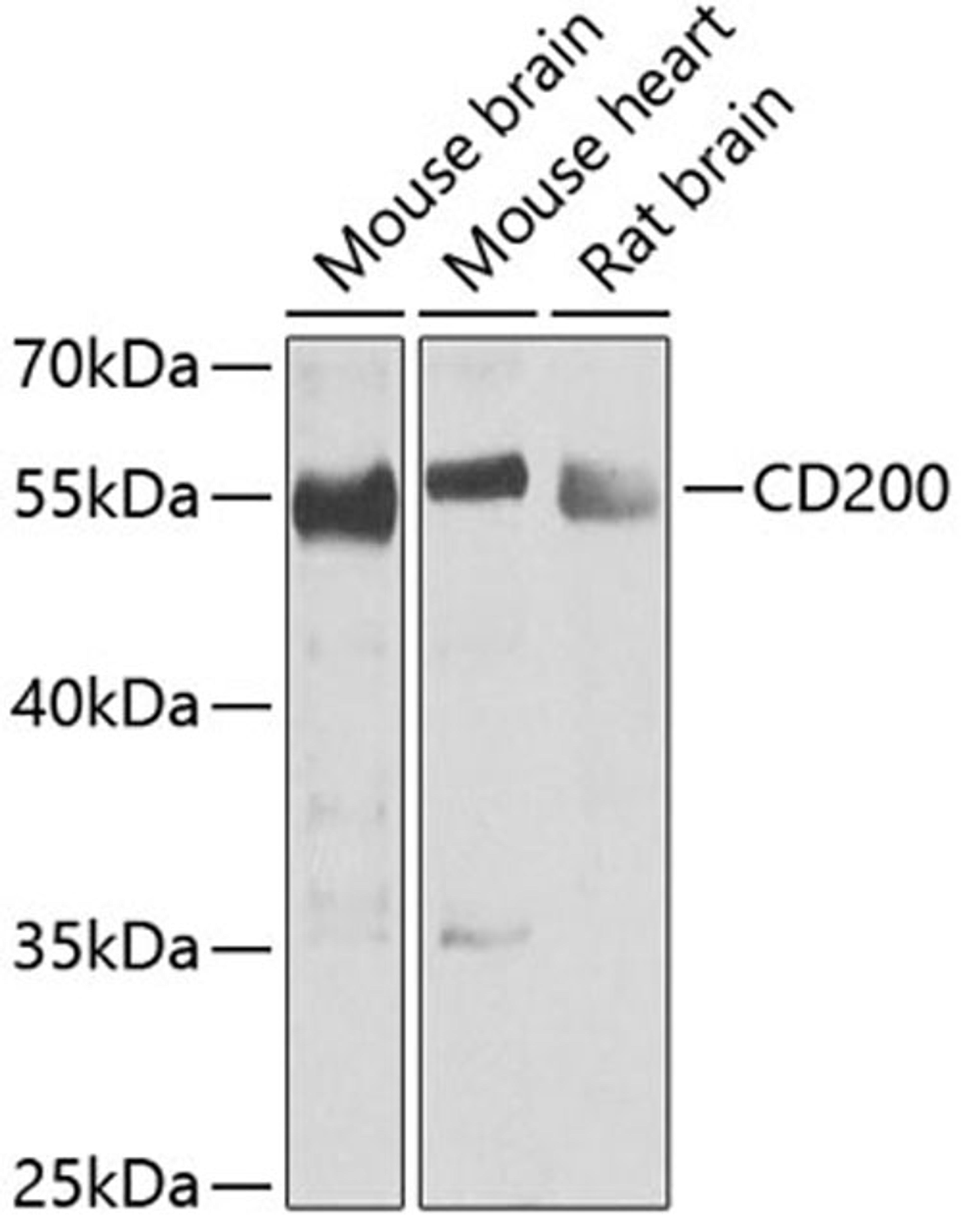 Western blot - CD200 antibody (A6552)