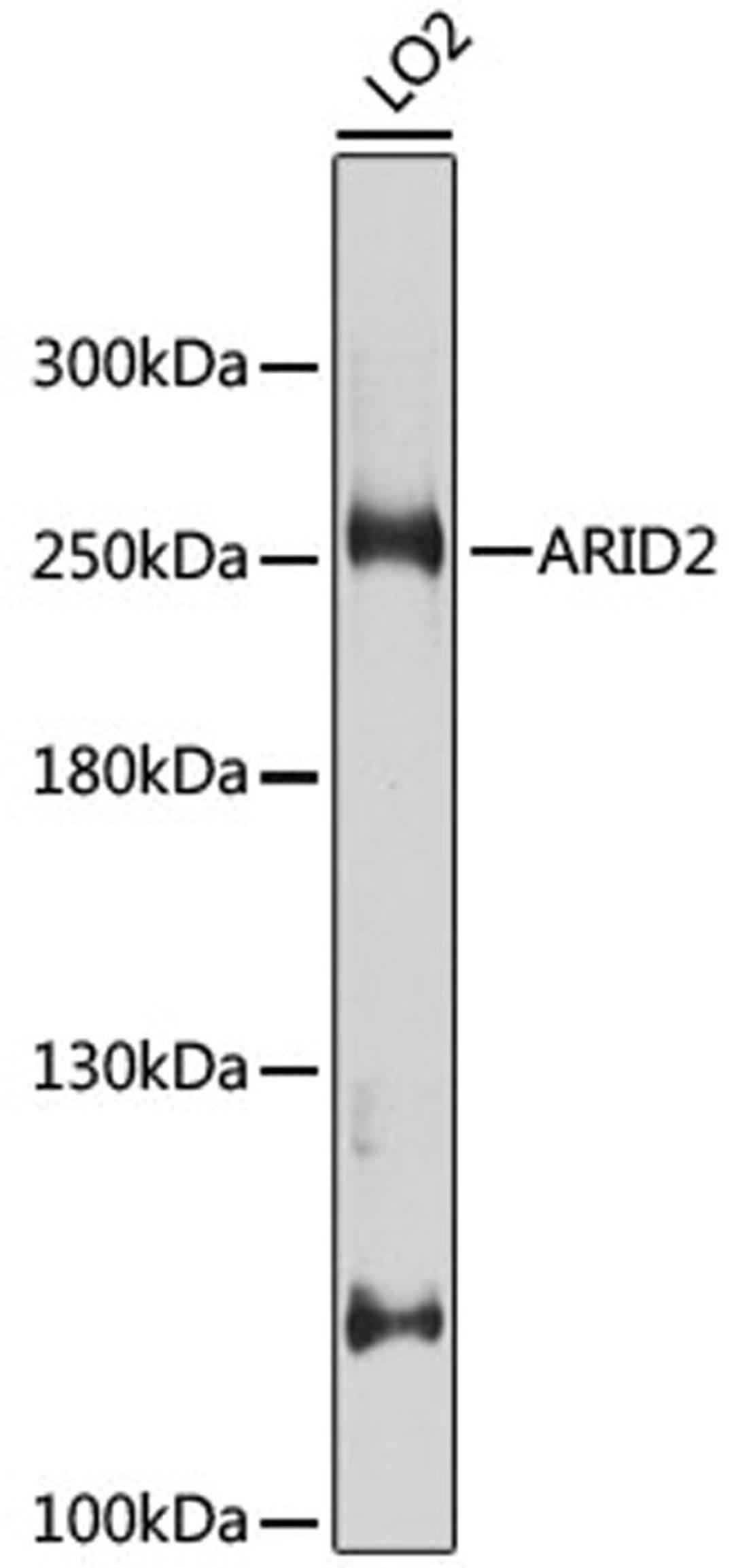 Western blot - ARID2 antibody (A8601)