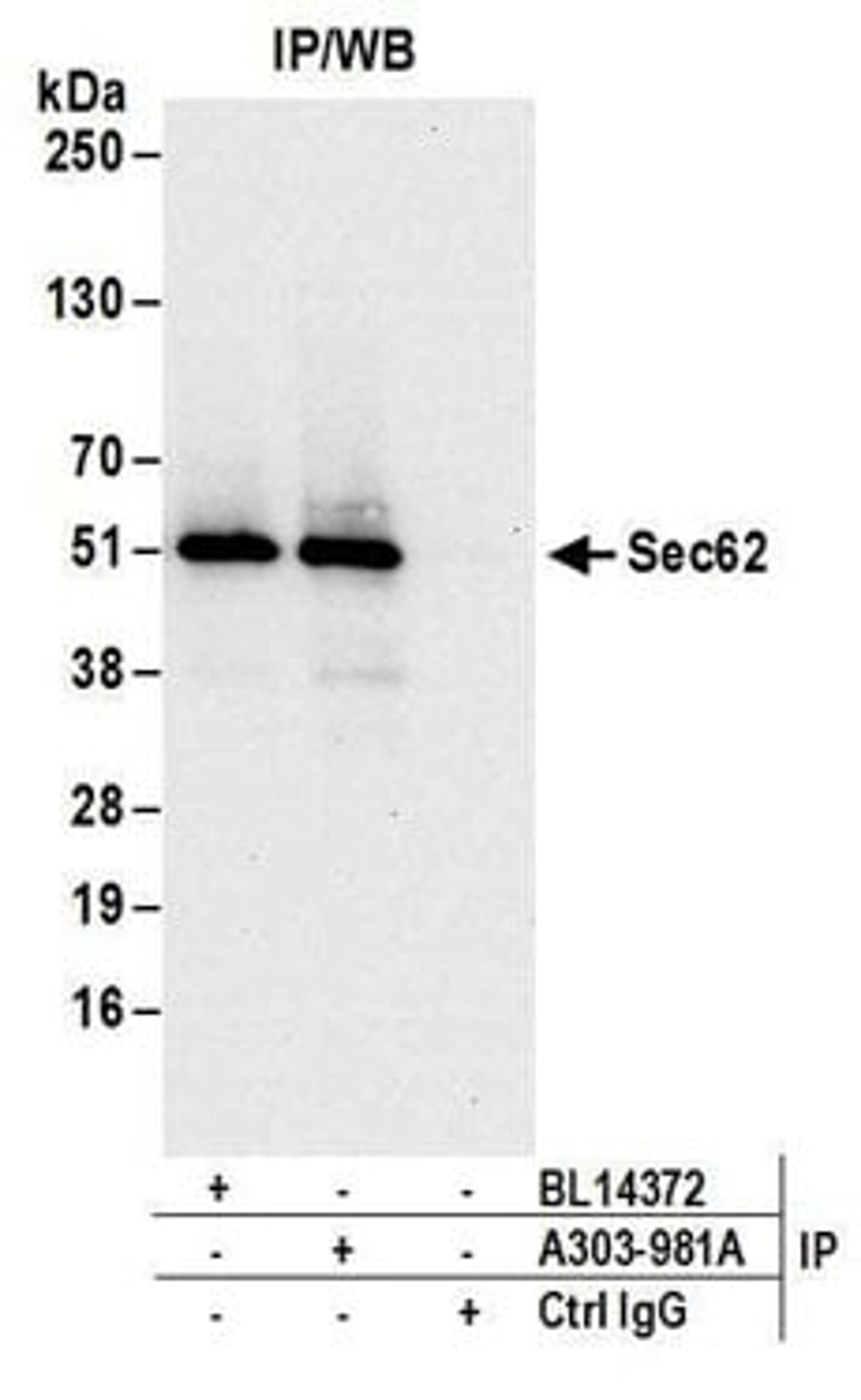 Detection of human Sec62 by western blot of immunoprecipitates.