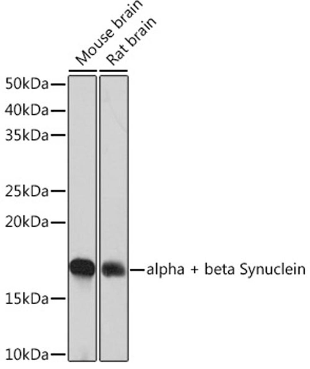 Western blot - alpha + beta Synuclein  Rabbit mAb (A4899)