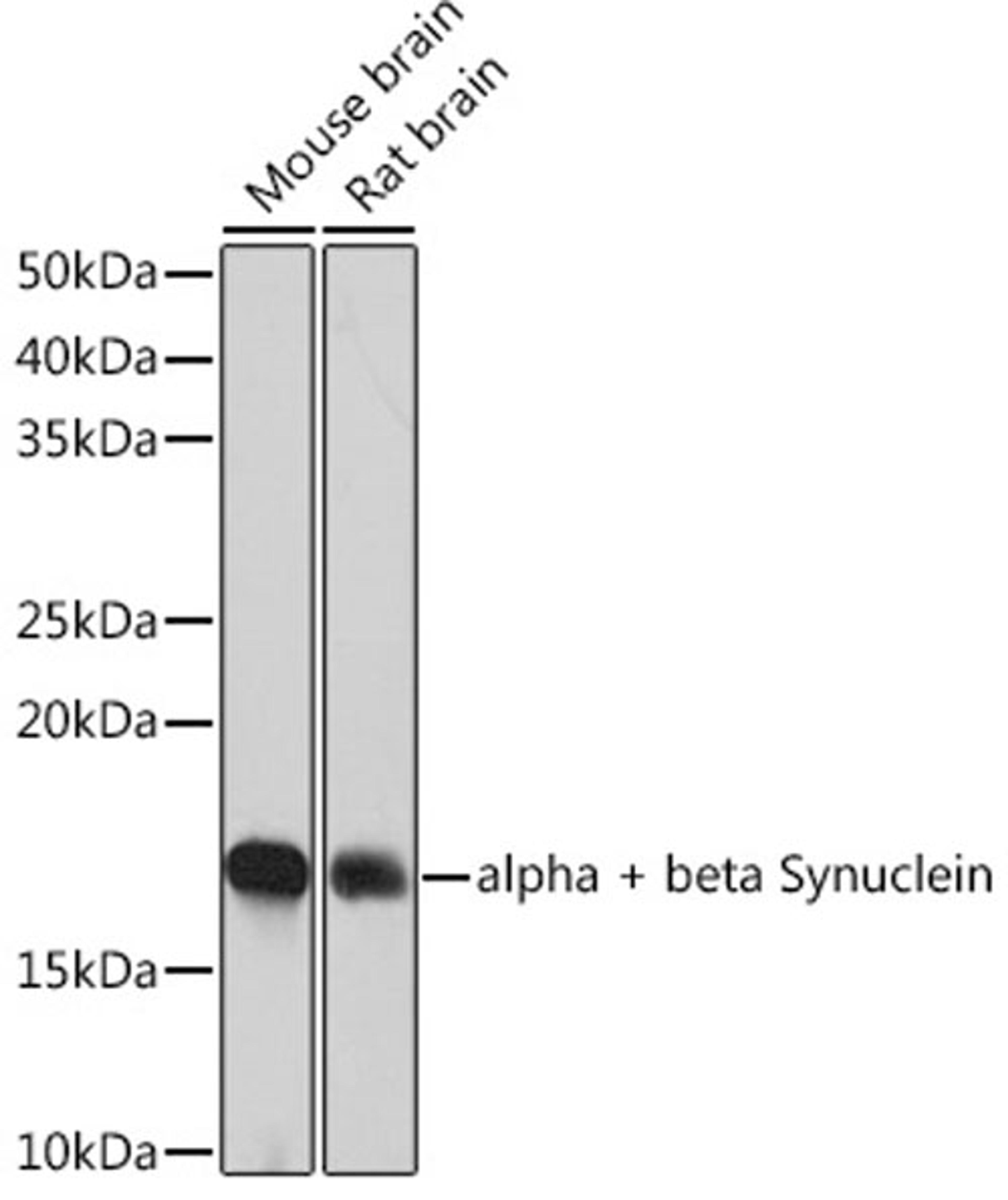 Western blot - alpha + beta Synuclein  Rabbit mAb (A4899)