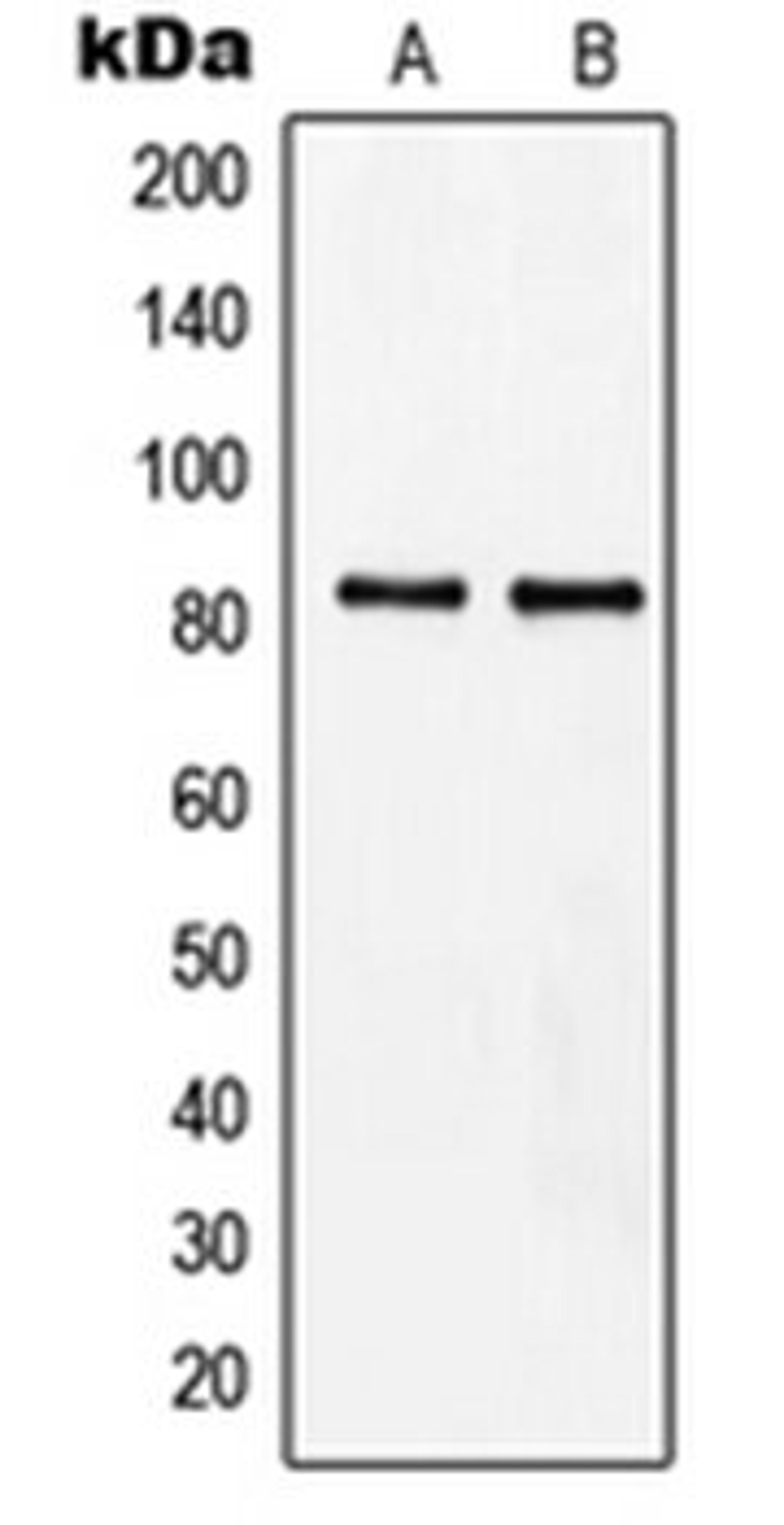 Western blot analysis of Raji (Lane 1), HeLa (Lane 2) whole cell lysates using MZF1 antibody