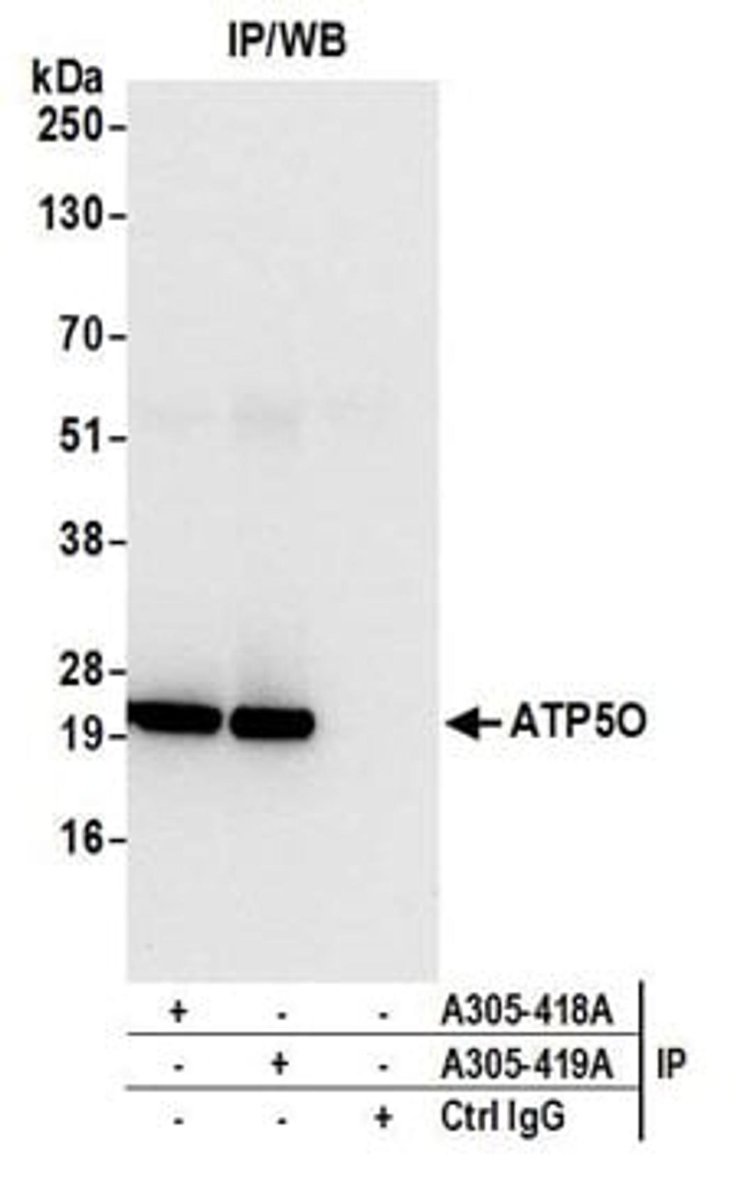 Detection of human ATP5O by western blot of immunoprecipitates.