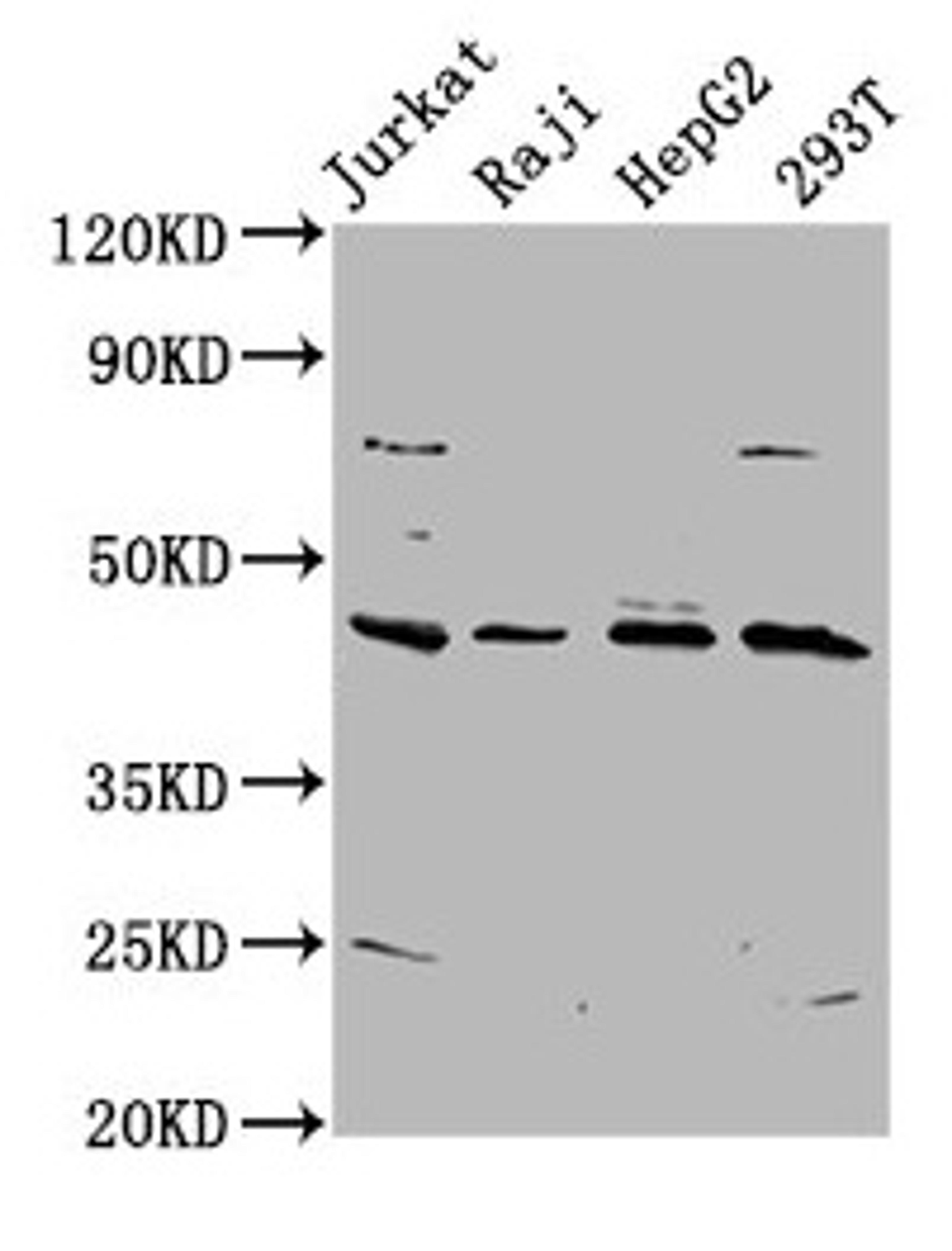 Western Blot. Positive WB detected in: Jurkat whole cell lysate, Raji whole cell lysate, HepG2 whole cell lysate, 293T whole cell lysate. All lanes: SPO11 antibody at 5.8µg/ml. Secondary. Goat polyclonal to rabbit IgG at 1/50000 dilution. Predicted band size: 45, 41 kDa. Observed band size: 45 kDa