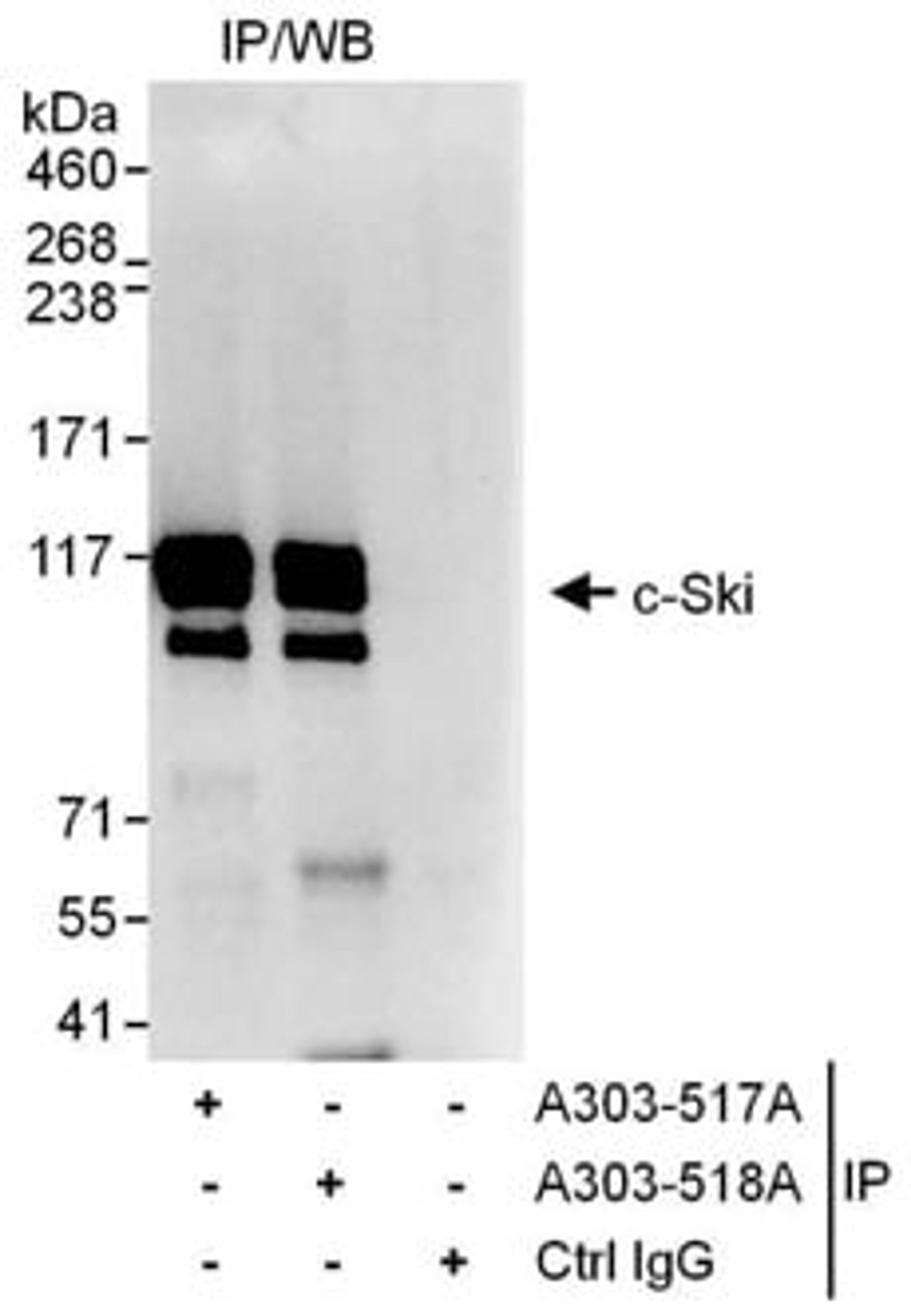 Detection of human c-Ski by western blot of immunoprecipitates.