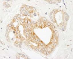 Detection of human p600 by immunohistochemistry.