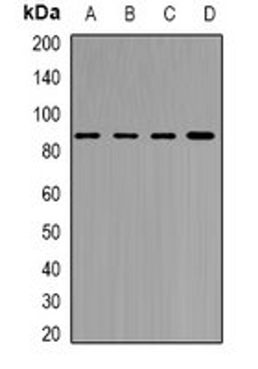 Western blot analysis of MCF7 (Lane1), Jurkat (Lane2), mouse brain (Lane3), rat brain (Lane4) whole cell lysates using YTHDC1 antibody