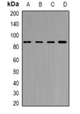 Western blot analysis of MCF7 (Lane1), Jurkat (Lane2), mouse brain (Lane3), rat brain (Lane4) whole cell lysates using YTHDC1 antibody