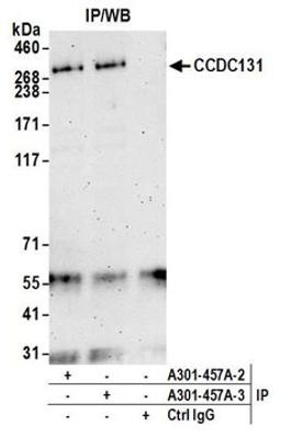 Detection of human CCDC131 by western blot of immunoprecipitates.