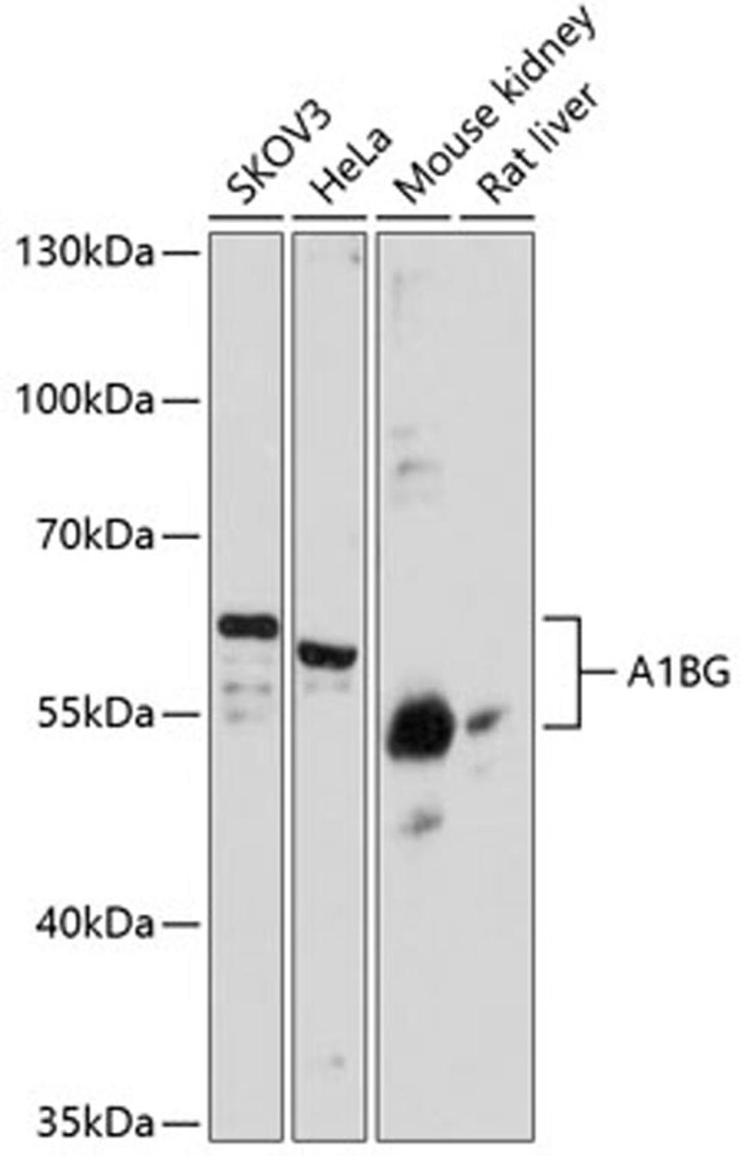 Western blot - A1BG antibody (A11583)