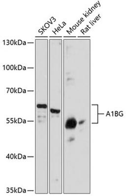 Western blot - A1BG antibody (A11583)